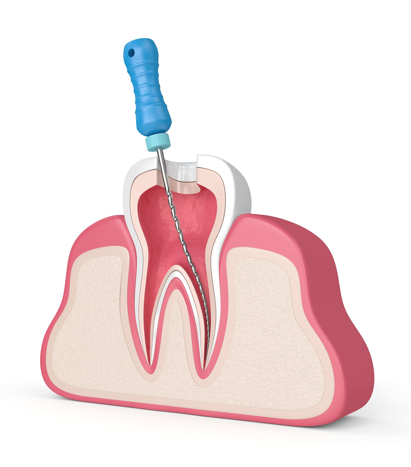 Root Canal Care